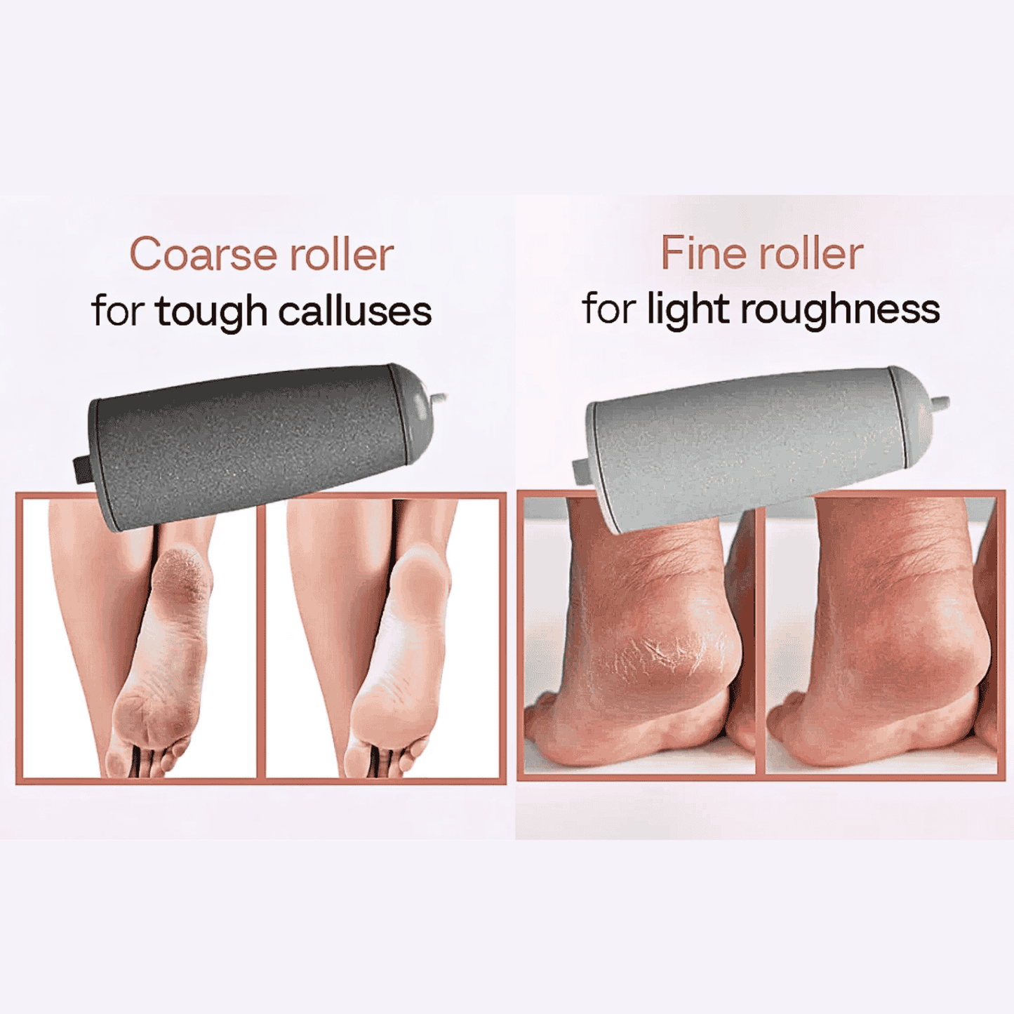 Pedicure Electric Foot Callus Remover