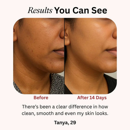 24K Gold Energy Beauty Bar Electric Facial Massage Roller - Diaarp