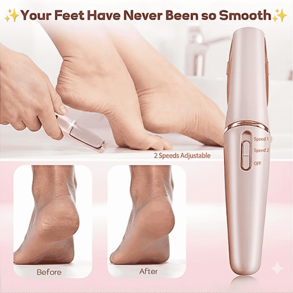 Pedicure Electric Foot Callus Remover