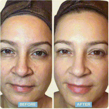 3-in-1 EMS LED Facial Sculptor – Advanced Skin Lift Device