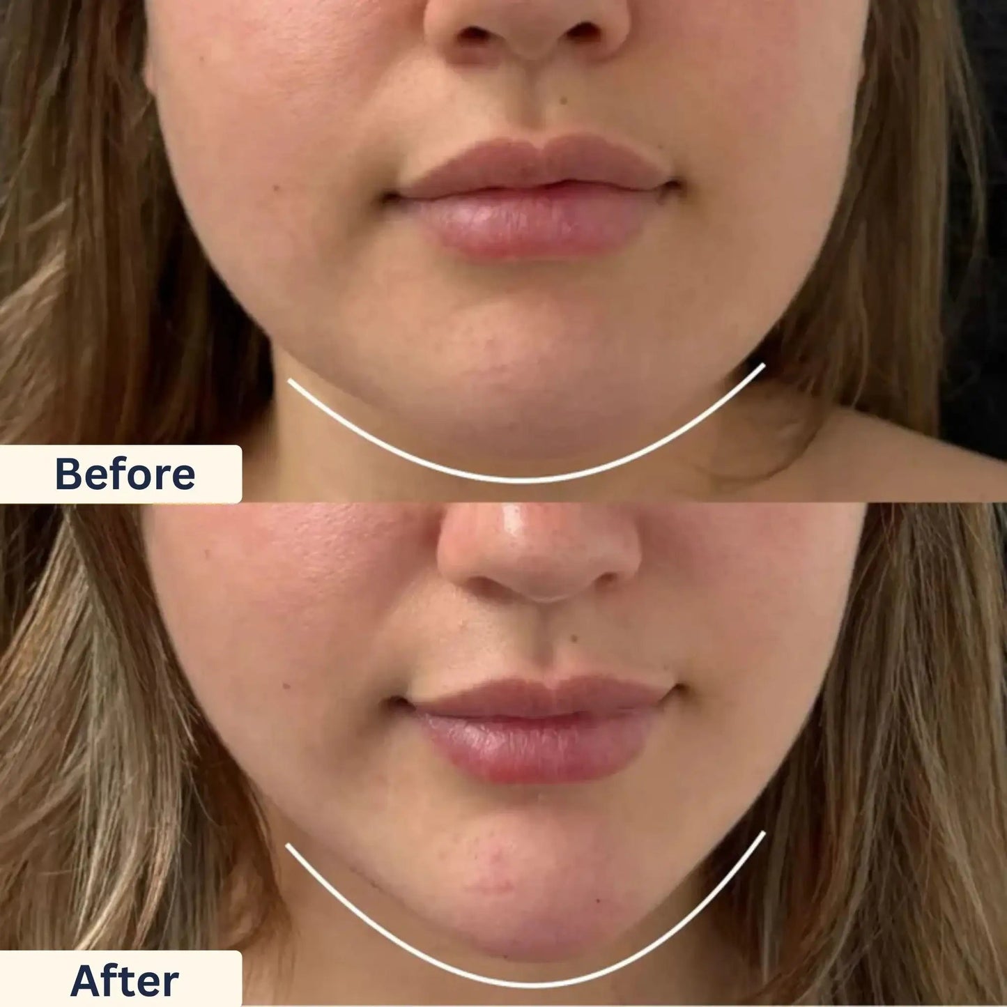 Lymphatic Contour Face Brush - Facial Massager for Jawline, Chin & Neck - Diaarp